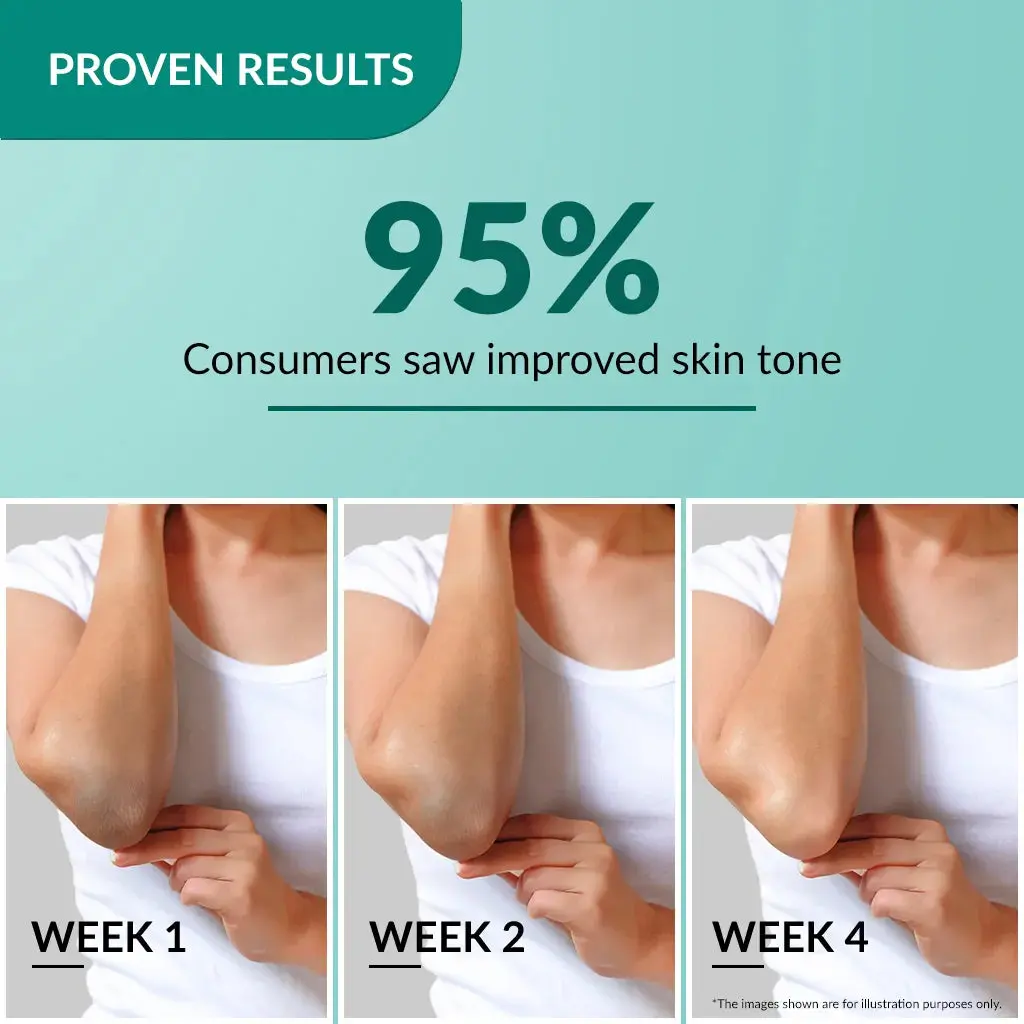 nigrifix-cream-50g-5.webp