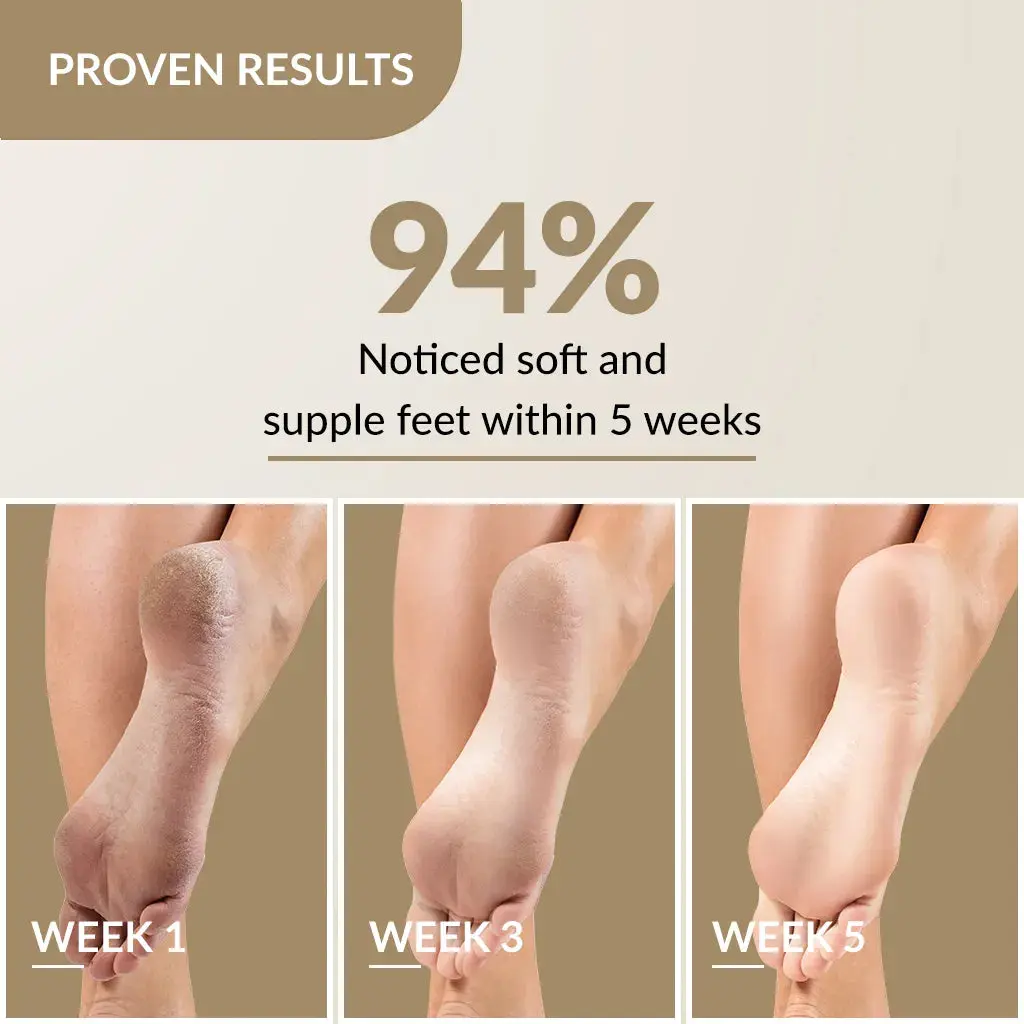 foobetik-foot-cream-4.webp