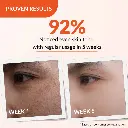 skarfix-tx-4.webp